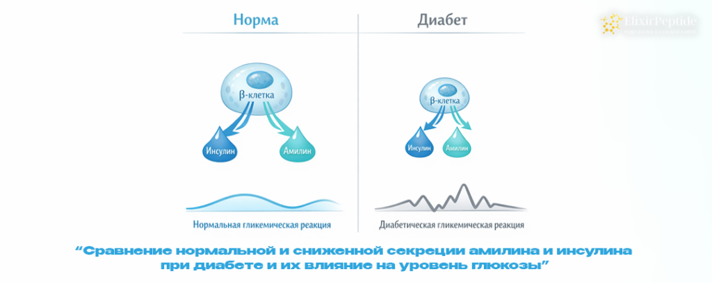 Сравнение нормальной и сниженной секреции амилина и инсулина при диабете и их влияние на уровень глюкозы.png Сравнение нормальной и сниженной секреции амилина и инсулина при диабете и их влияние на уровень глюкозы.png